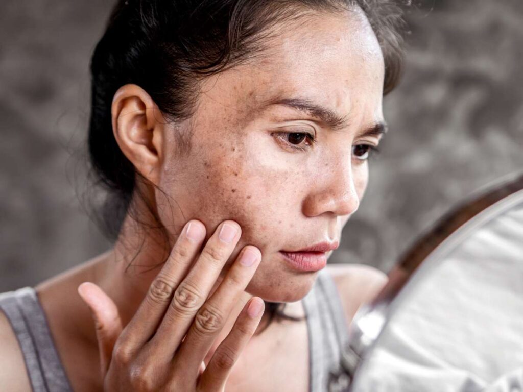 How To Use Licorice Root Extract To Improve Hyperpigmentation 37